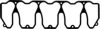 VICTOR REINZ 71-35969-00 Gasket, cylinder head cover